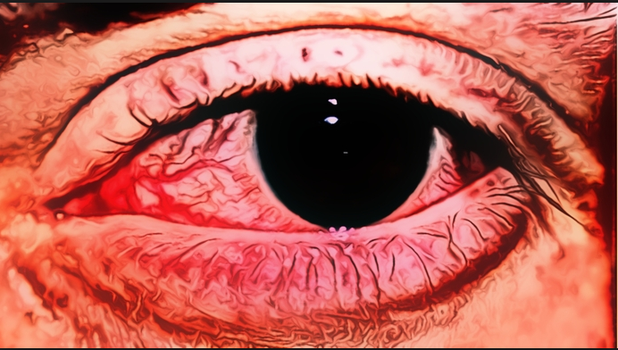Cara Menyembuhkan Mata Keratitis Secara Alami